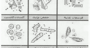 الفحص الميكروسكوبي لعينات البول Examination of Urine
