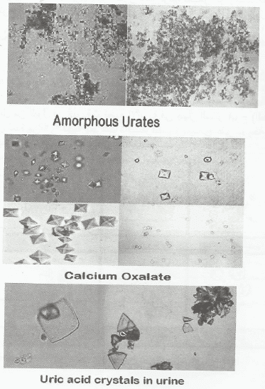 الفحص الميكروسكوبي لعينات البول Examination of Urine