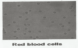 الفحص الميكروسكوبي لعينات البول : خلايا كرات الدم الحمراء