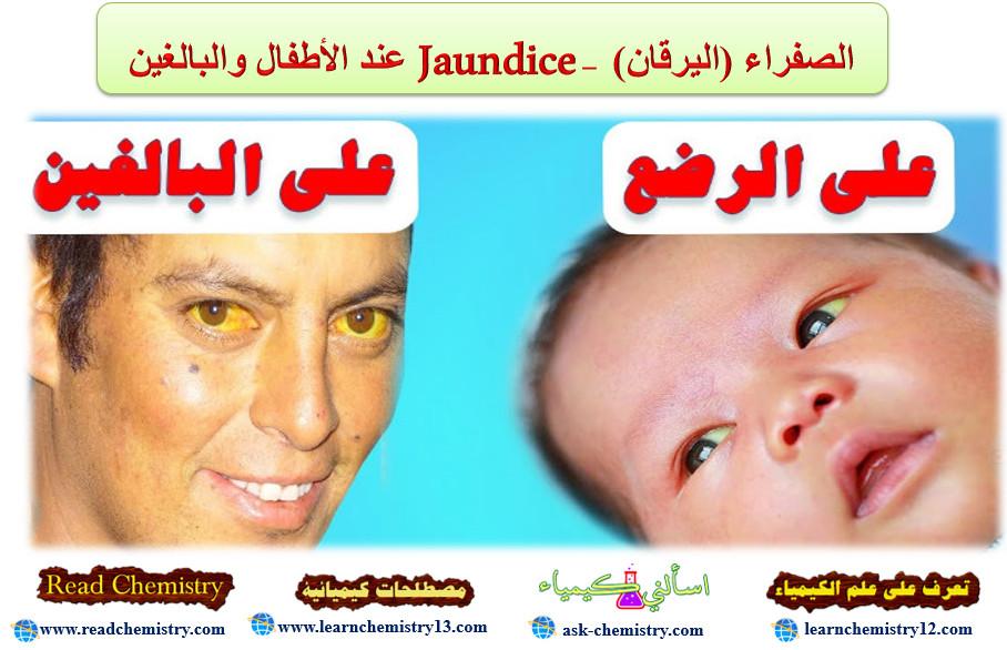 الصفراء (اليرقان) Jaundice – عند الأطفال والبالغين