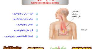 ارتجاع المريء Gastroesophageal reflux