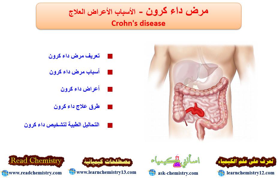 مرض داء كرون Crohn's disease الأسباب الأعراض العلاج