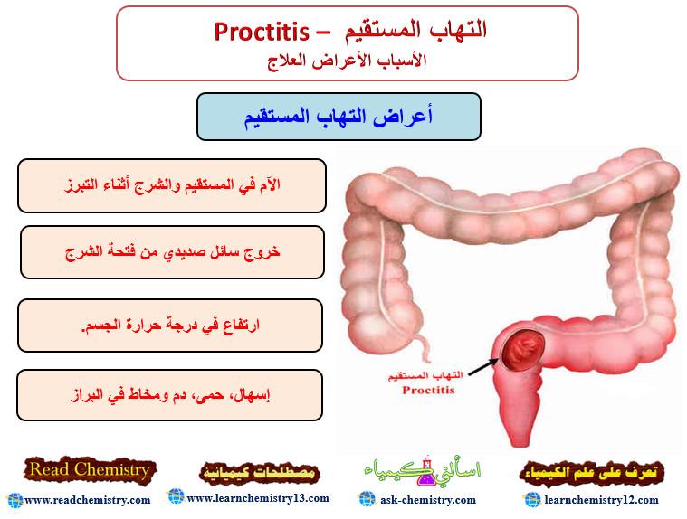 التهاب المستقيم Proctitis – الأسباب الأعراض العلاج