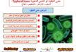 حمى التيفود أو الحمى المعوية Typhoid fever