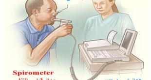مرض الربو (حساسية الصدر) Asthma