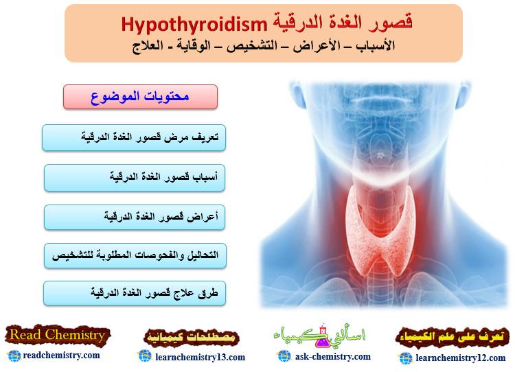 قصور الغدة الدرقية Hypothyroidism - الأسباب والعلاج