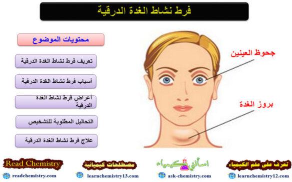 فرط نشاط الغدة الدرقية داء جويتر أو داء جريفز تعرف على علم الكيمياء فرط نشاط الغدة الدرقية داء جويتر أو داء جريفز تعرف على علم الكيمياء