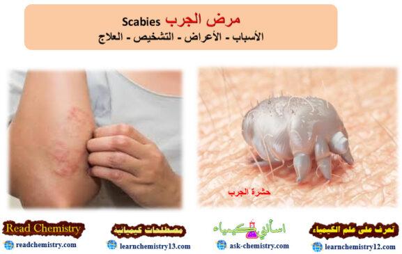 الجرب Scabies - الأسباب الاعراض العلاج | تعرف على علم الكيمياء